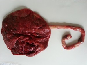 placenta.1